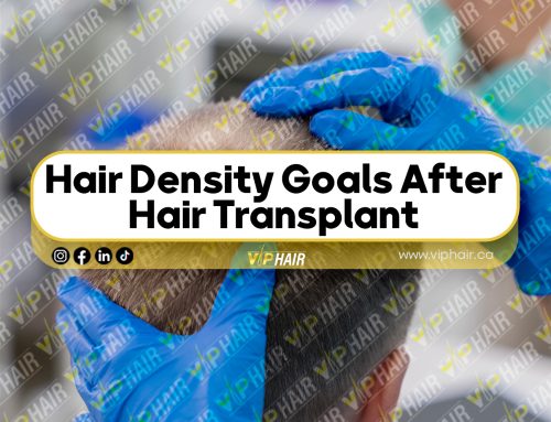 Hair Density Goals After Hair Transplant: What’s Realistic in Toronto