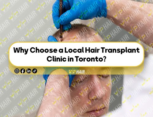 Why Choose a Local Hair Transplant Clinic in Toronto?