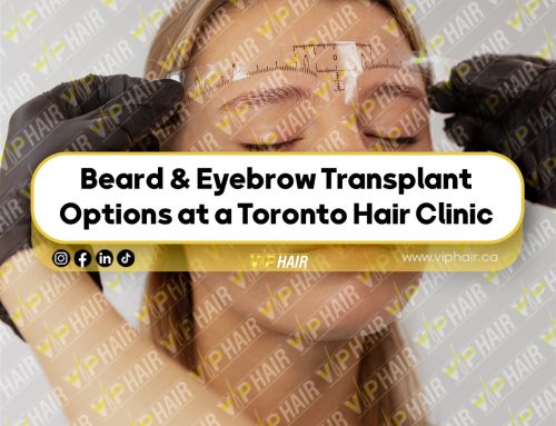 Beard & Eyebrow Transplant Options at a Toronto Hair Clinic